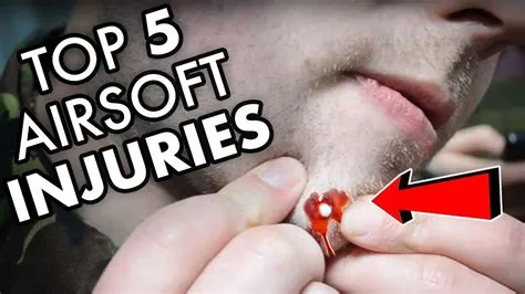 Do airsoft bullets hurt?