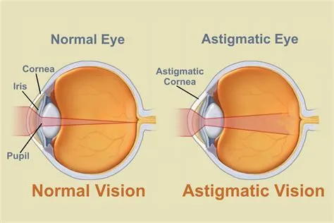 Is 1.0 astigmatism bad?