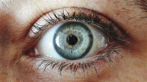 What is the rarest eye ever?