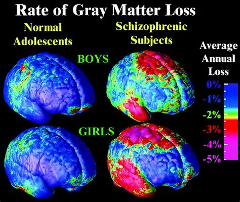 Do we lose grey matter as we age?