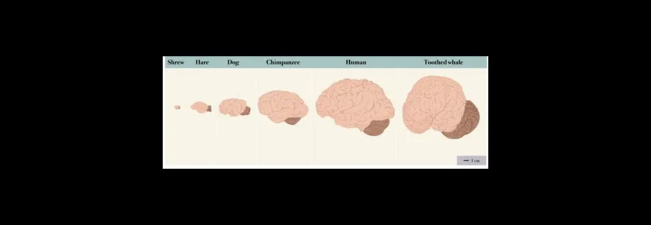 Does iq affect brain size?