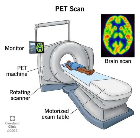 Can a pet scan detect psp?