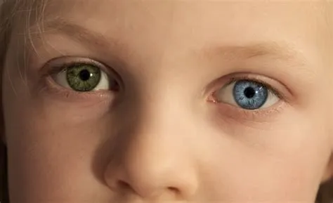 What color eyes will baby have?