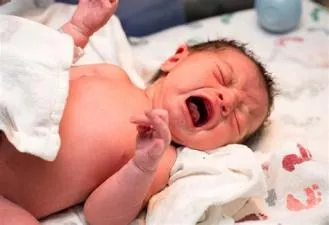 What causes the baby not to cry after birth?