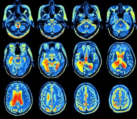 Is a pet scan as bad as an mri?