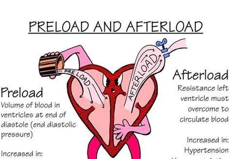 What does higher preload do?