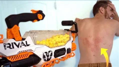 Does nerf gun shot hurt?