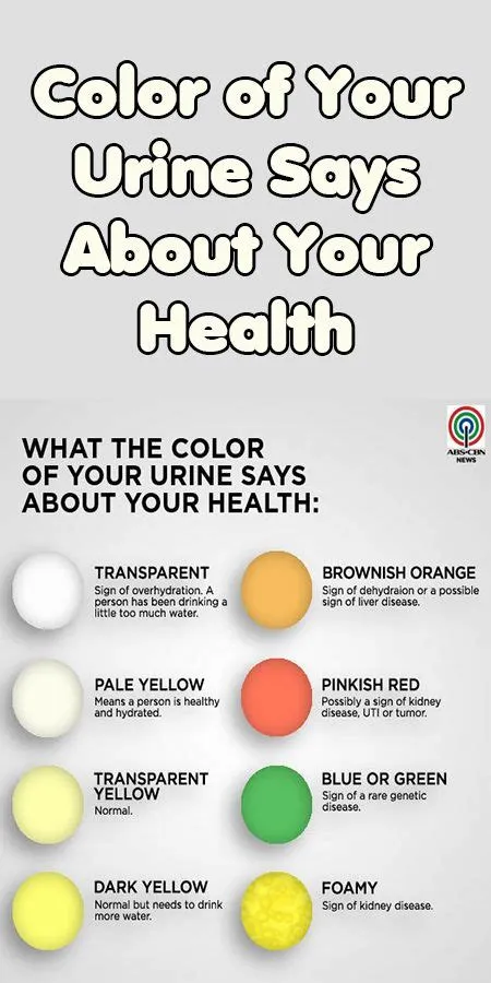 What color is urine with baby boy?