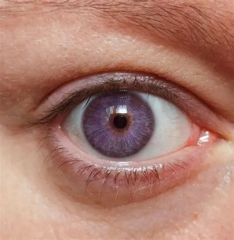 Do violet eyes exist?