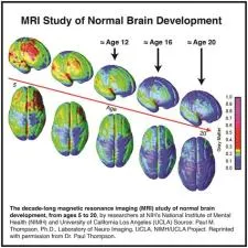 How mature is a 13 year olds brain?