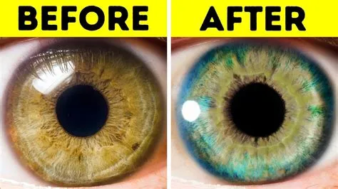 Does eye color change with age?