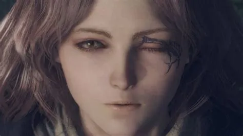 Who is the girl with the weird eye in elden ring?