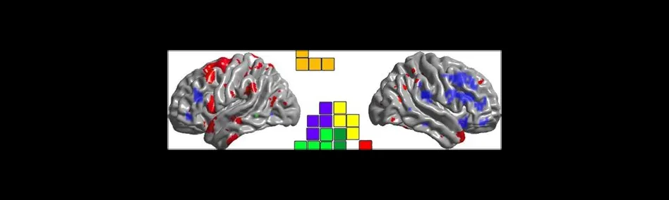 What part of the brain is tetris?