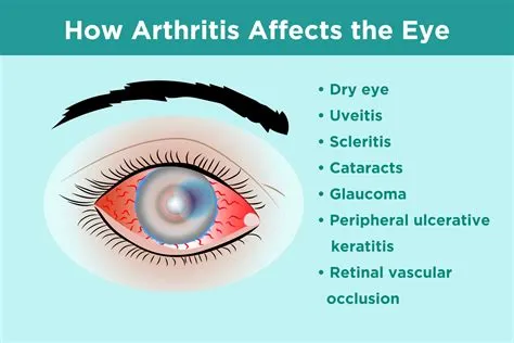 Does hz affect eyes?