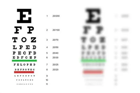 Is 2100 vision legally blind?